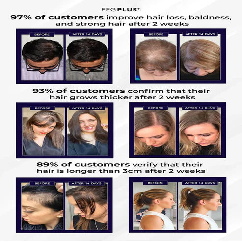 FEG Plus Hair Growth Serum Spray – 50ml (For Men and Women)